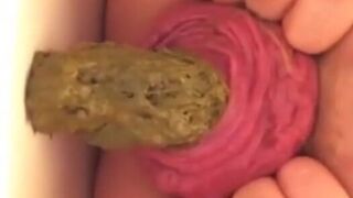 Prolapse Pro (Closeup), ScatKings.com Scat Porn 10 ScatKings.com Scat Porn